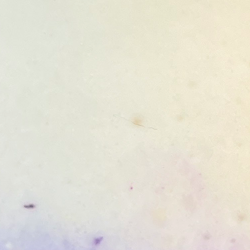 Ilaneer njaval (double layer)